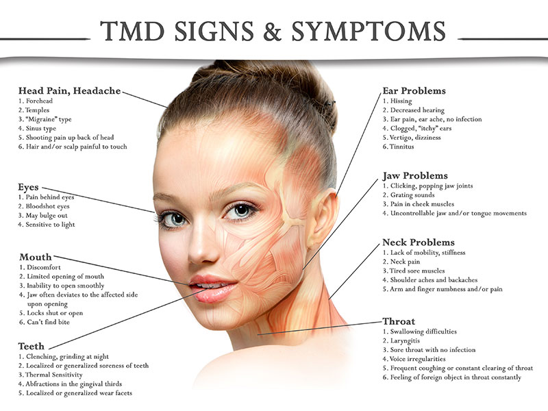 TMJ Syndrome